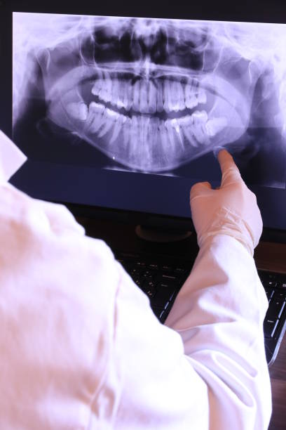 Best Dentist for Tooth Abscess  in Silver Creek, NY